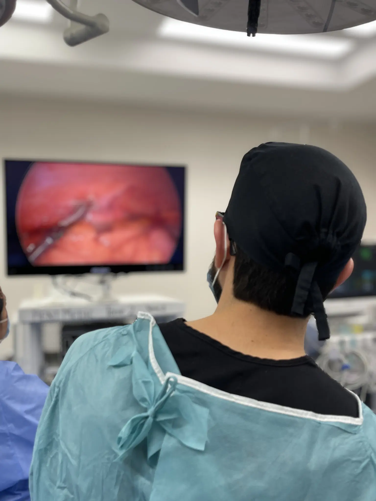 Ilustración de Conversión Bariátrica