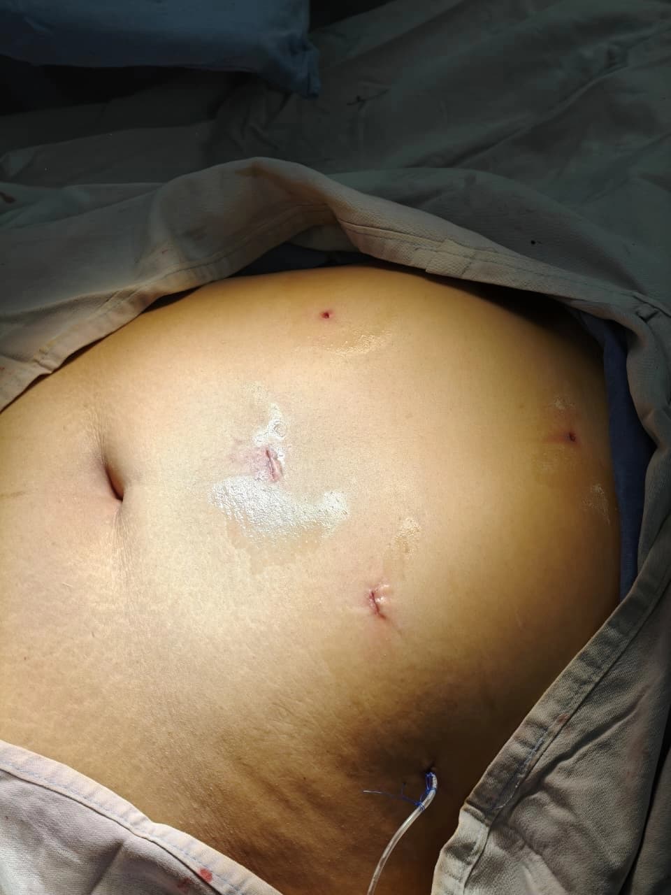 Ilustración de Mínima Invasión