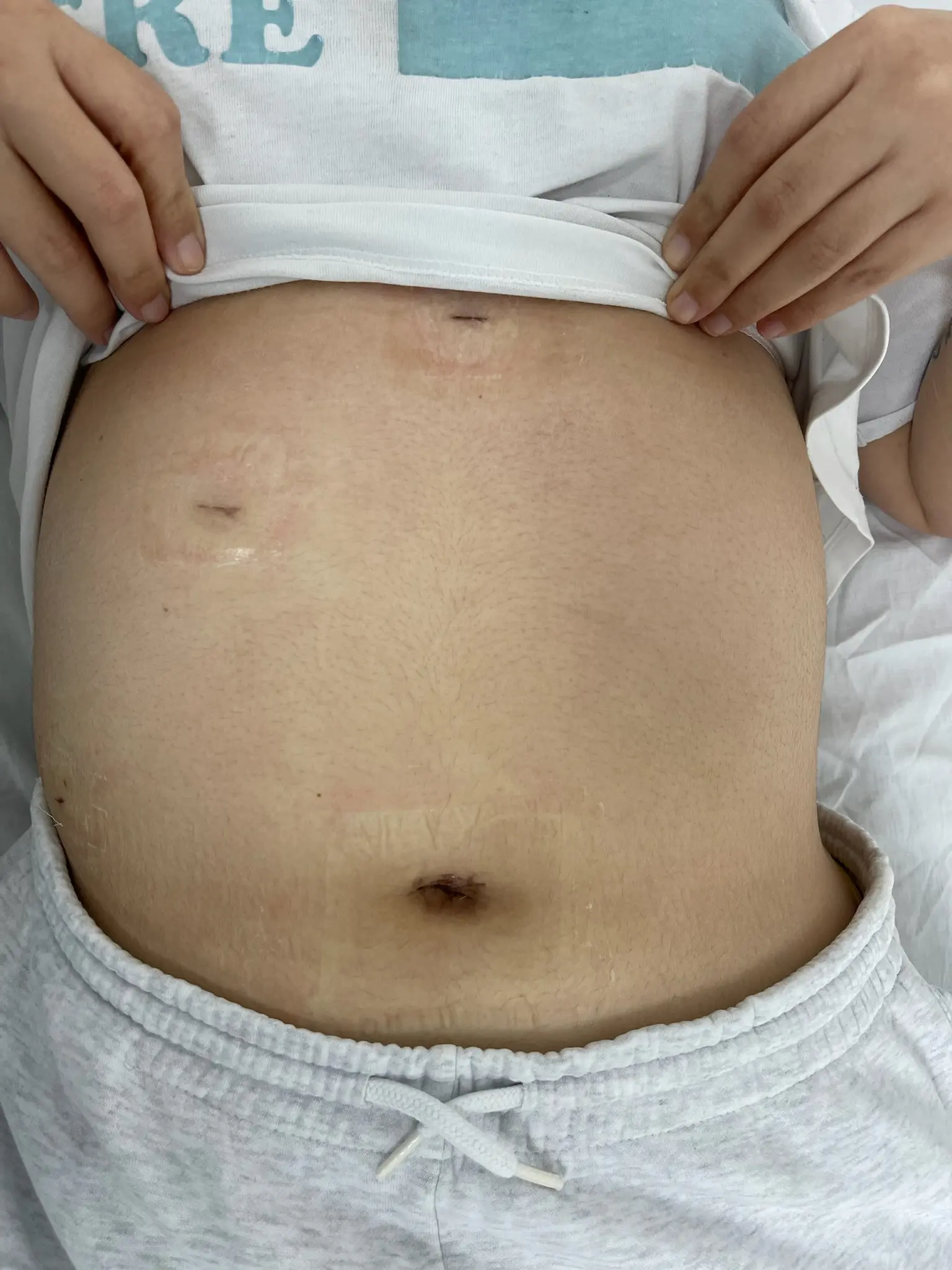 Ilustración de Puerto Único