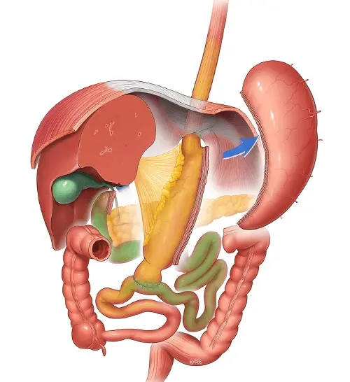Ilustración de SADI-S
